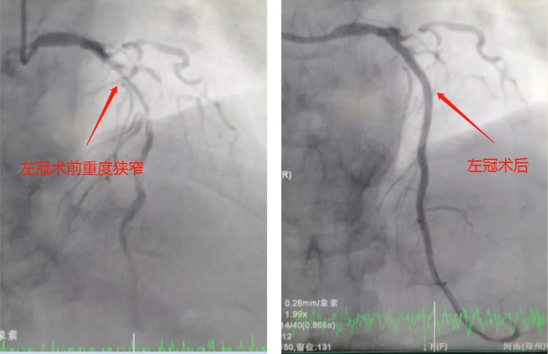 1628739624850706.png 微信图片_20210812114011.png